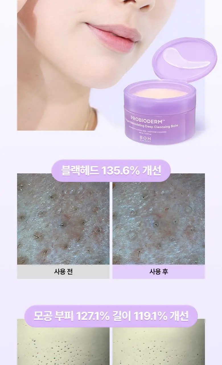 [모공딥클렌징] 바이오힐보 프로바이오덤 콜라겐 리모델링 딥 클렌징 밤 100mL 상세페이지 7
